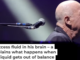 Billy Joel was diagnosed with normal pressure hydrocephalus. Ethan Miller/Getty Images